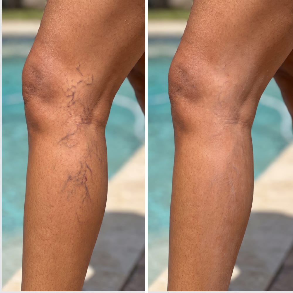 Customer photo review of Body Coverage Perfector