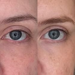 Customer photo review of EyeLift™ Repair Cream