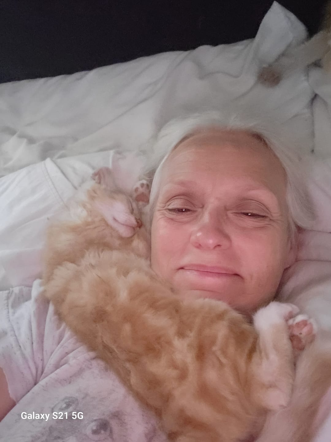 Customer photo review of mussage 8 Hour Sleep Patch