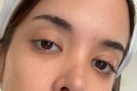 Customer photo review of TX Retinalsome Double Effect Eyecream