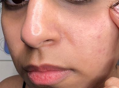 Customer photo review of TX Retinalsome Double Effect Eyecream