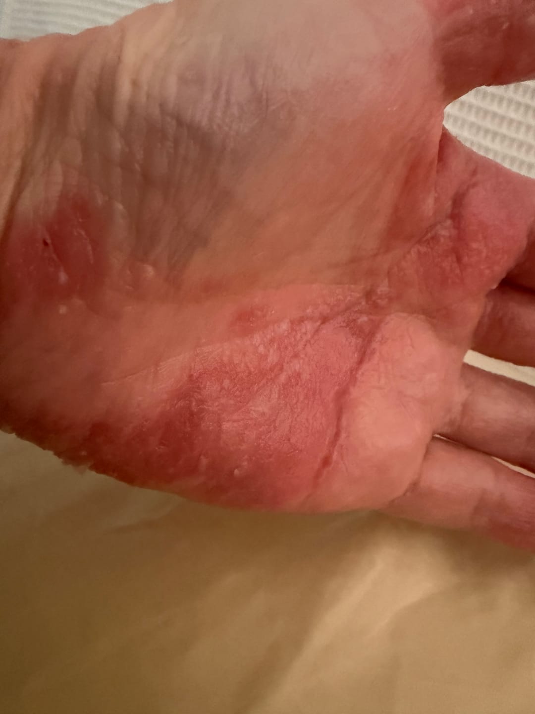 Customer photo review of DermaGen Manuka Oil Balm