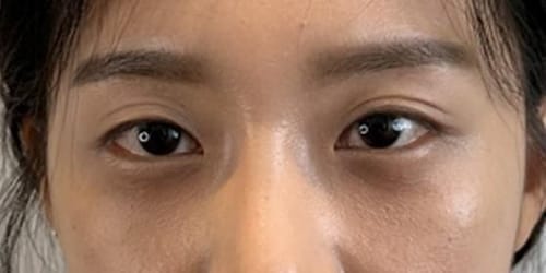 Customer photo review of EX Derma Booster Sonic Shot