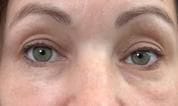 Customer photo review of Eyephalt Eyebag Cream