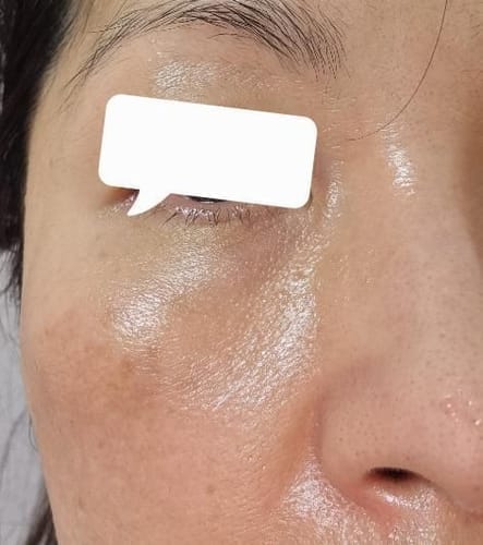 Customer photo review of Cemenrete Eye care Line
