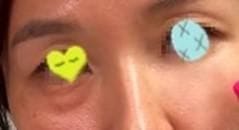 Customer photo review of Eyephalt Eyebag Cream