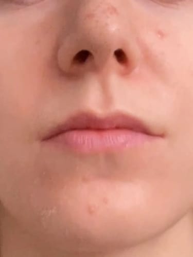 Customer photo review of Peel Shot Glow Black Rice Ampoule