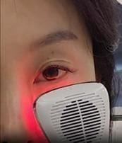 Customer photo review of EX Derma Booster Sonic Shot