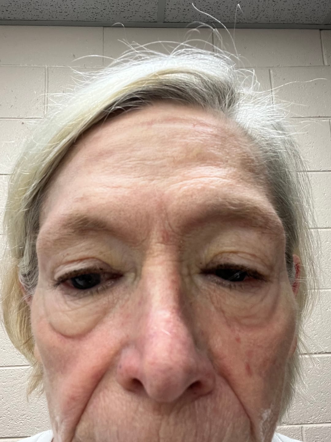 Customer photo review of NanoClear™ Strike Swim Goggles Clear (White/Black)