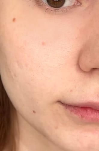 Customer photo review of TX Retinalsome Double Effect Eyecream