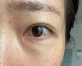 Customer photo review of Cemenrete Eye care Line