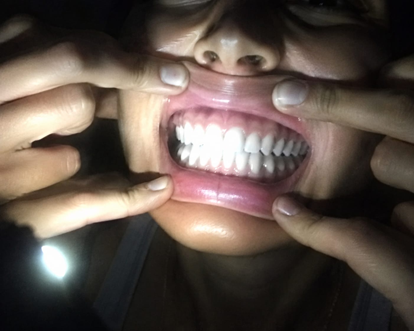 Customer photo review of Enjuague Bucal Morado