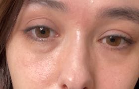 Customer photo review of Retinol Eyebag Cream