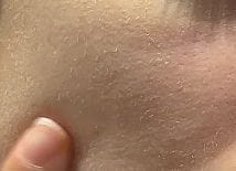 Customer photo review of Peel Shot Glow Black Rice Ampoule