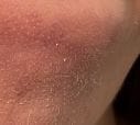 Customer photo review of Peel Shot Glow Black Rice Ampoule