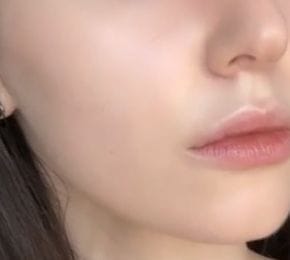 Customer photo review of Peel Shot Glow Black Rice Ampoule