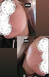 Customer photo review of NiaHydra™ Skin Serum