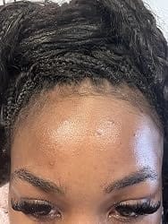 Customer photo review of NiaHydra™ Skin Serum