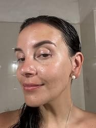 Customer photo review of NiaHydra™ Skin Serum