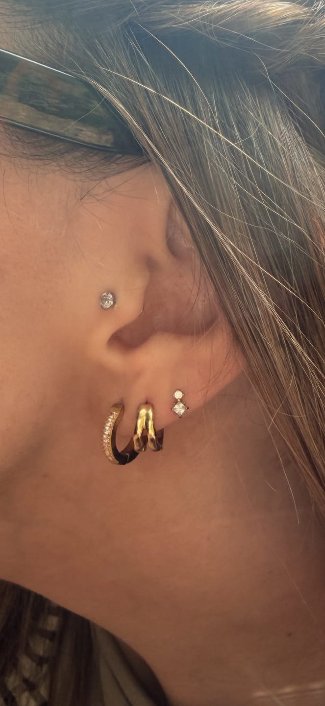 Customer photo review of The Molten Duo Huggie