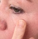 Customer photo review of Retinol Eyebag Cream