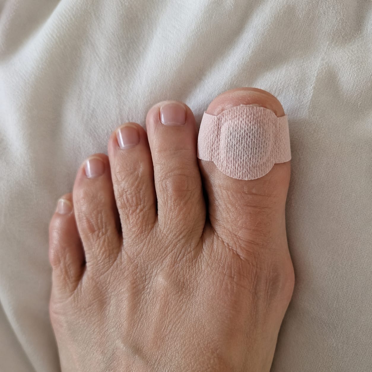 Customer photo review of NAGLA™ Nattplåster