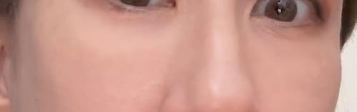 Customer photo review of Retinol Eyebag Cream