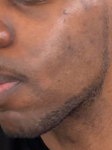 Customer photo review of Peel Shot Glow Black Rice Ampoule