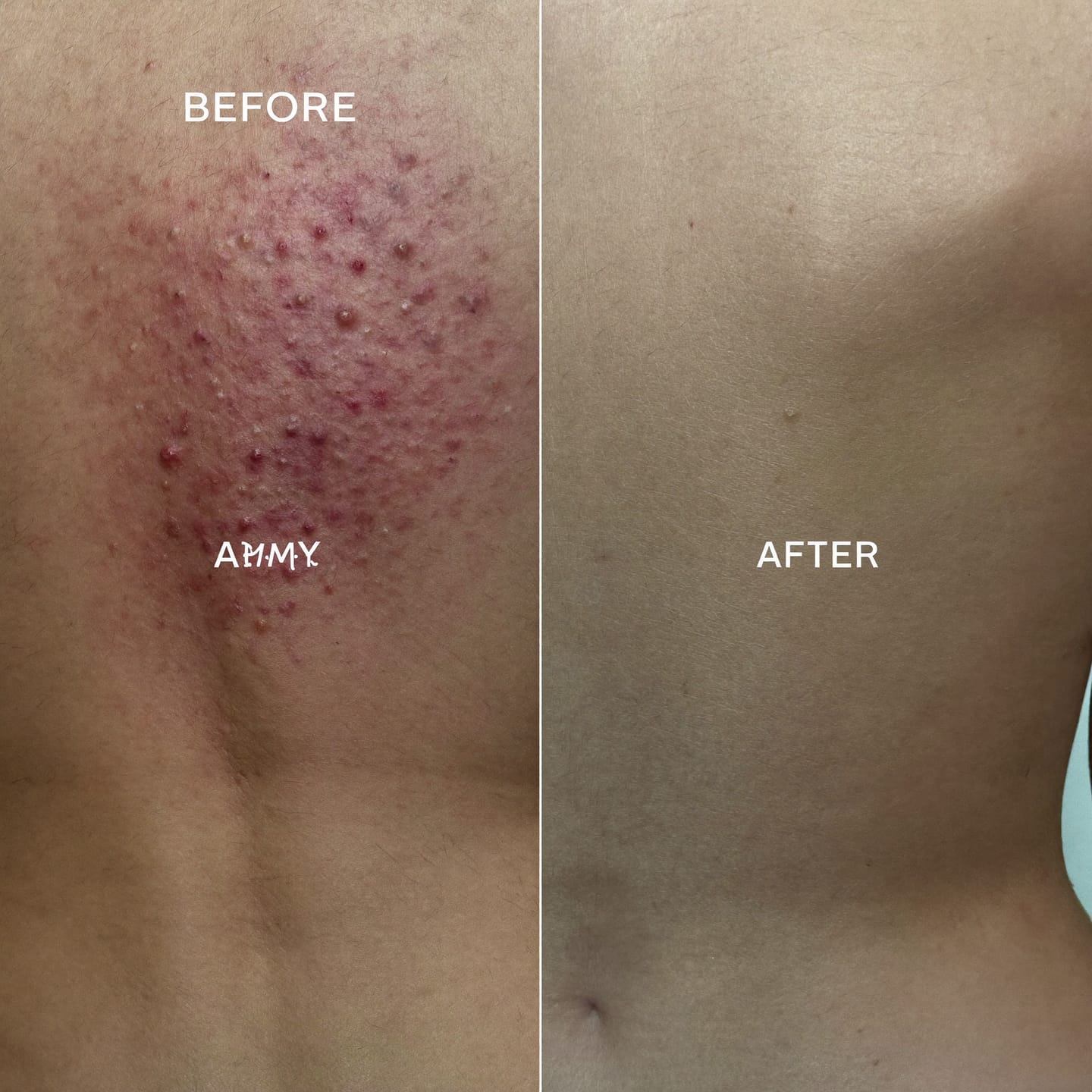 Customer photo review of Soothe Burning, Itching & Wetness Where Skin Meets Skin | Relief You Feel on Contact