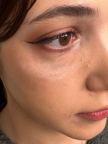 Customer photo review of Retinol Eyebag Cream