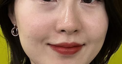 Customer photo review of Eyephalt Eyebag Cream