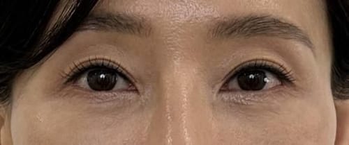 Customer photo review of EX Derma Booster Sonic Shot