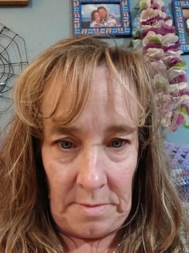 Customer photo review of Eyephalt Eyebag Cream