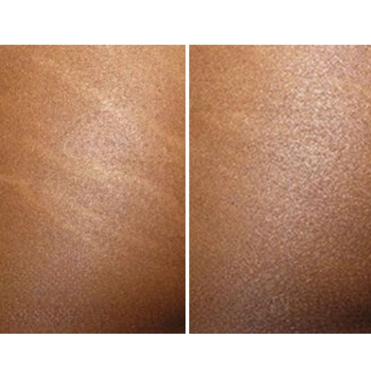 Customer photo review of Striae & Darkspots Routine: Glow Bar + Glow Serum