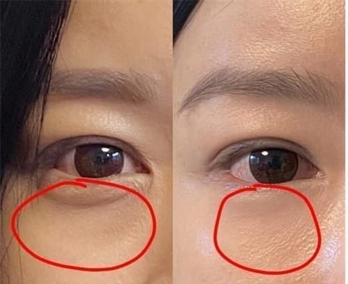 Customer photo review of EX Derma Booster Sonic Shot