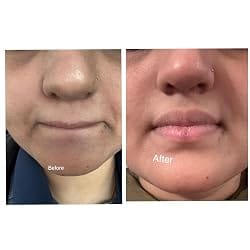 Customer photo review of NiaHydra™ Skin Serum