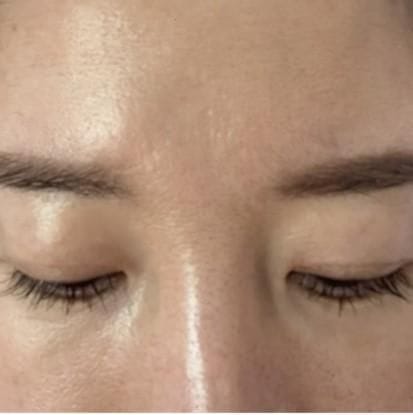 Customer photo review of Cemenrete Eye care Line