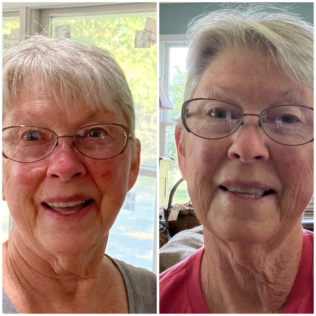 Customer photo review of Tallow & Honey Balm - 2 oz