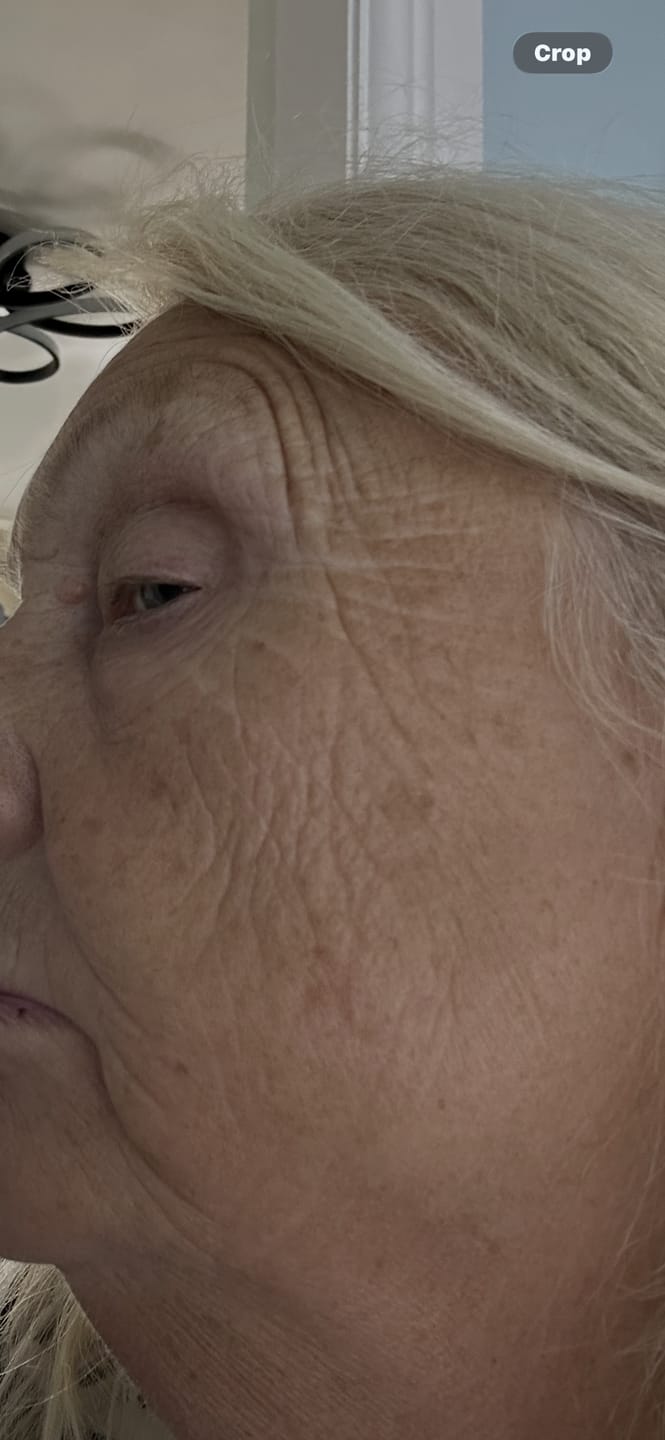 Customer photo review of Pro-Ageing Plump & Firm Duo