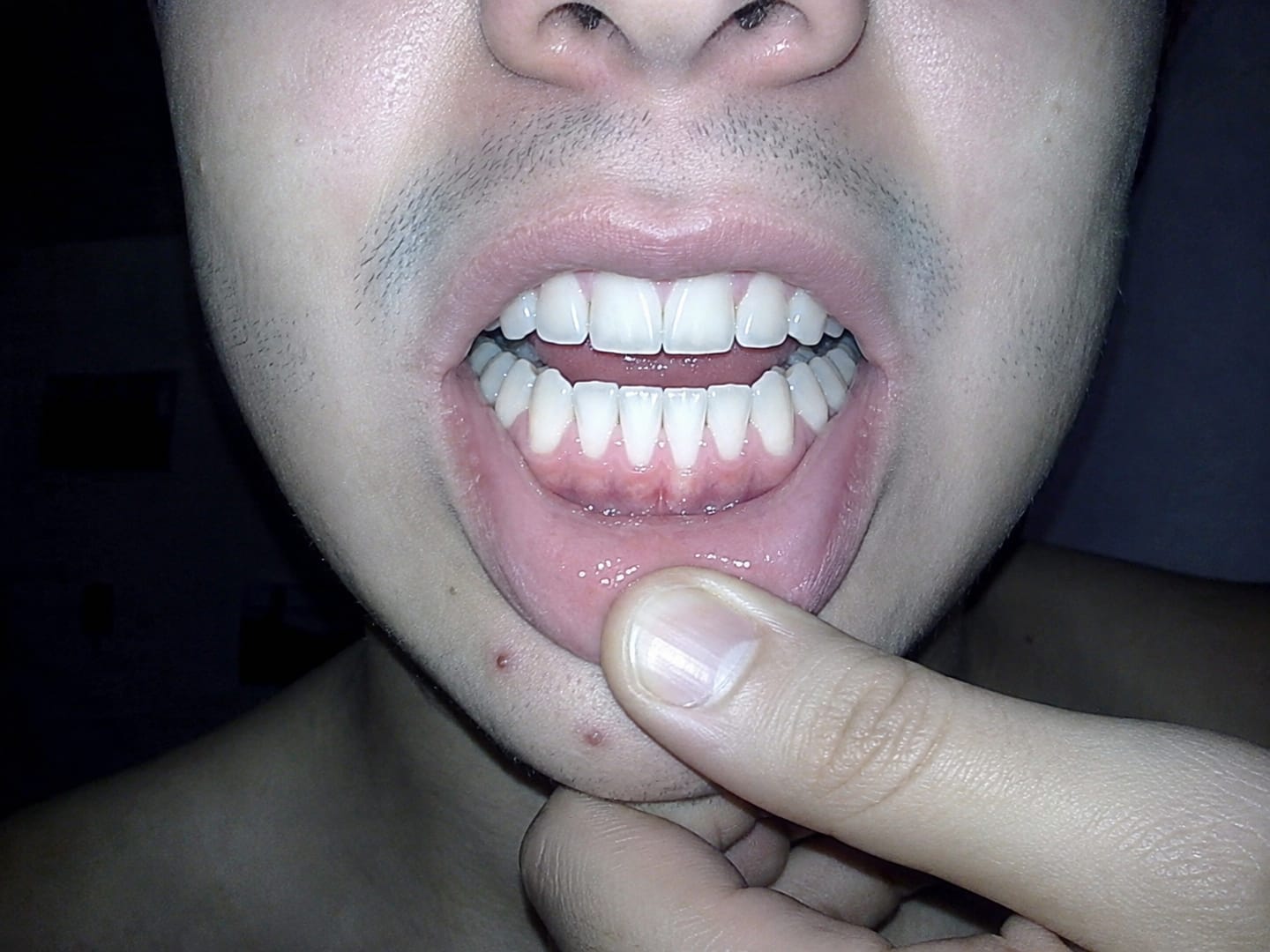 Customer photo review of Enjuague Bucal Morado