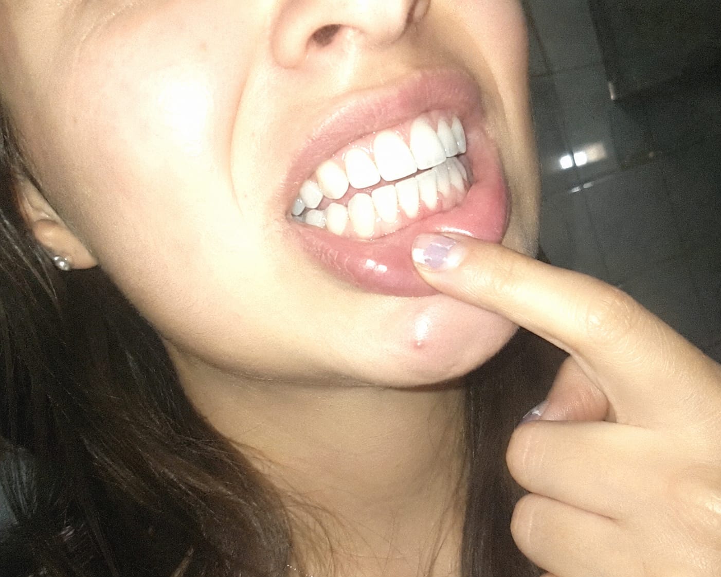 Customer photo review of Enjuague Bucal Morado