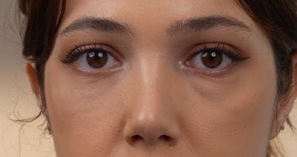 Customer photo review of Retinol Eyebag Cream