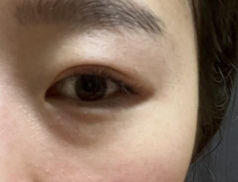Customer photo review of Cemenrete Eye care Line