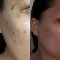 Customer photo review of NiaHydra™ Skin Serum