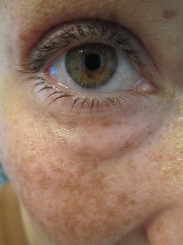 Customer photo review of Eyephalt Eyebag Cream