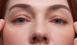 Customer photo review of Retinol Eyebag Cream