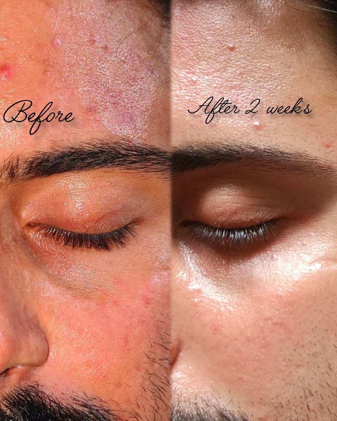 Customer photo review of Barrier Restore Moisturizing Facial Lotion