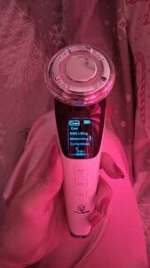 Customer photo review of EXLUVIAN SkinPro 5