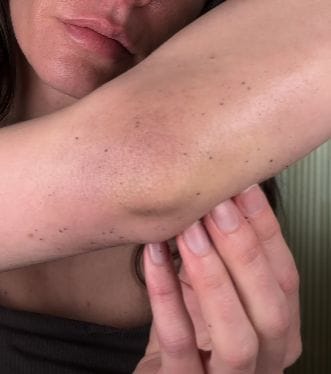 Customer photo review of Peel Shot Glow Black Rice Ampoule
