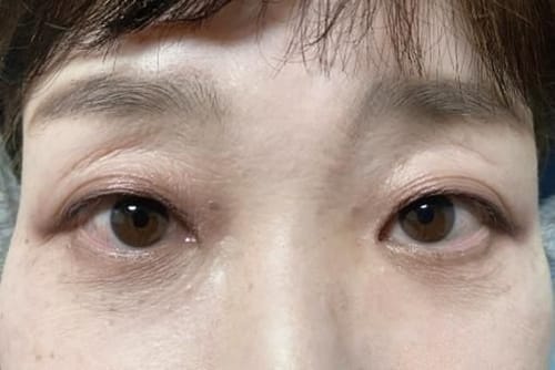 Customer photo review of Cemenrete Eye care Line